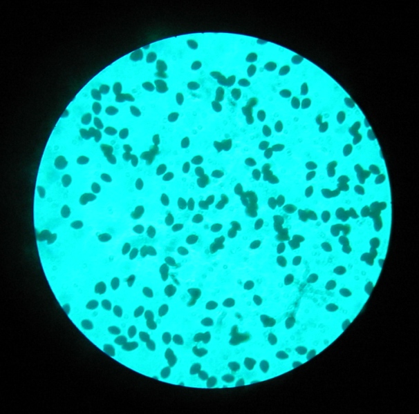 Ritrovamento in giardino